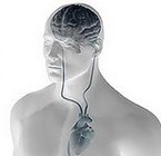 Identificando la Embolia